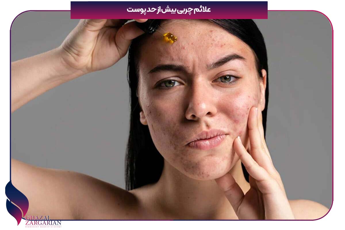 چگونه چربی صورت را از بین ببریم