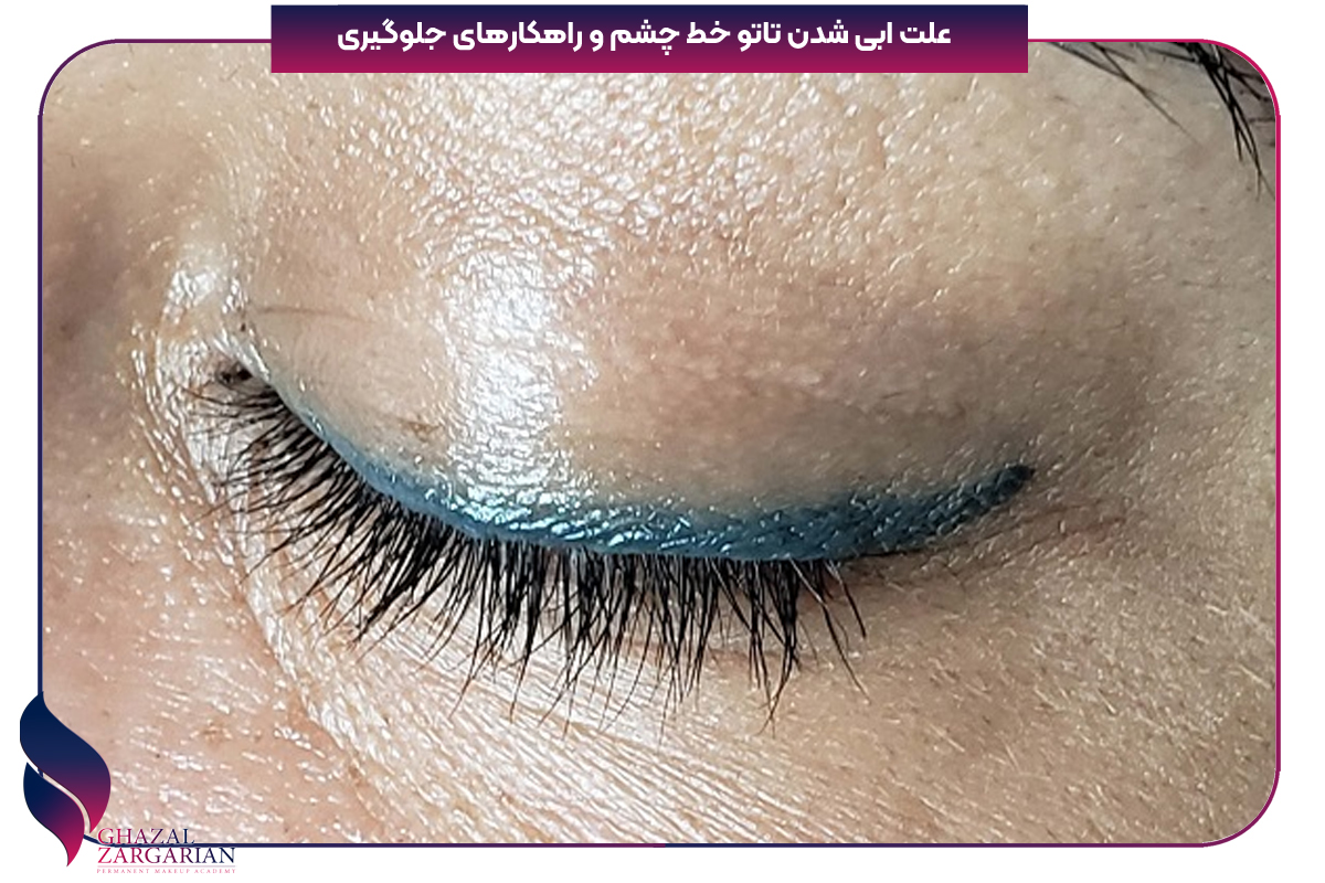 علت ابی شدن رنگ خط چشم 3 روش سریع درمان