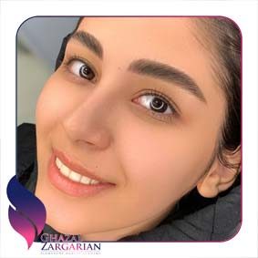 فیبروز ابرو چیست