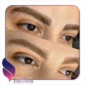 بعد از ریموو ابرو چیکار کنیم بعد از ریموو ابرو چیکار کنیم