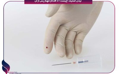 نیدل استیک چیست؟ 3 اقدام مهم پس از آن