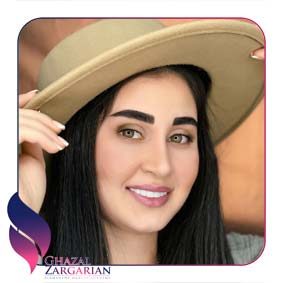 رویال بروز ابرو چیست رویال بروز ابرو چیست