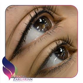مراقبت بعد از بن مژه مراقبت بعد از بن مژه