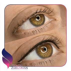 عکس بن مژه دنباله دار عکس بن مژه دنباله دار