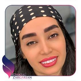 ابرو رویال بروز ابرو رویال بروز