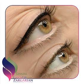 بن مژه درد داره بن مژه درد داره