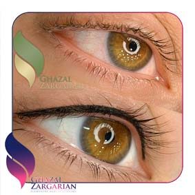 بن مژه چشم بن مژه چشم