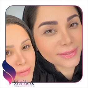 ابرو میکرو دخترانه ابرو میکرو دخترانه