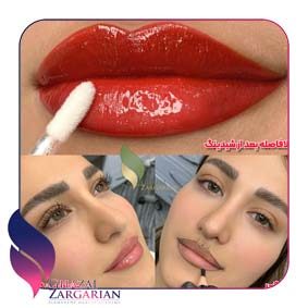 شیدینگ لب شیدینگ لب
