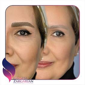 مدل جدید ابرو فیبروز مدل جدید ابرو فیبروز