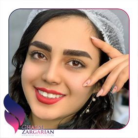 میکروبلیدینگ انواع تاتو ابرو میکروبلیدینگ انواع تاتو ابرو