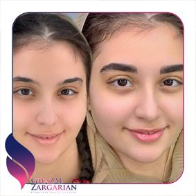 هزینه میکروبلیدینگ ابرو هزینه میکروبلیدینگ ابرو